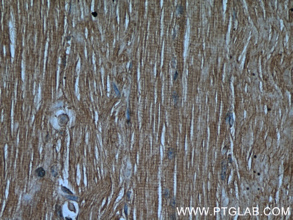 Immunohistochemistry (IHC) staining of human skeletal muscle tissue using CaMKII gamma-Specific Polyclonal antibody (55140-1-AP)