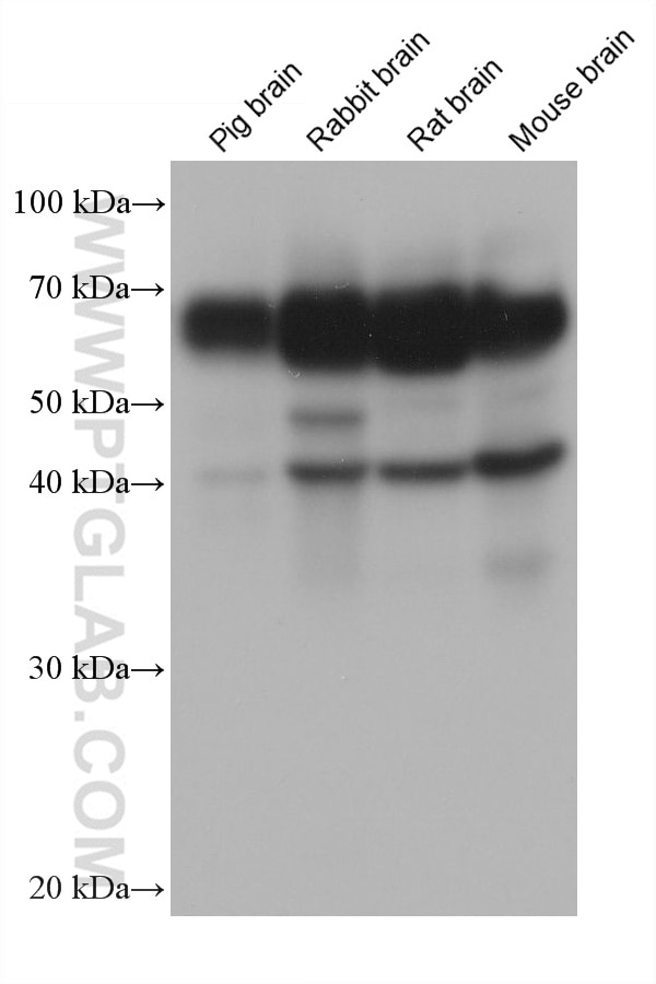 Western Blot (WB) analysis of various lysates using CAMK2G Monoclonal antibody (68519-1-Ig)
