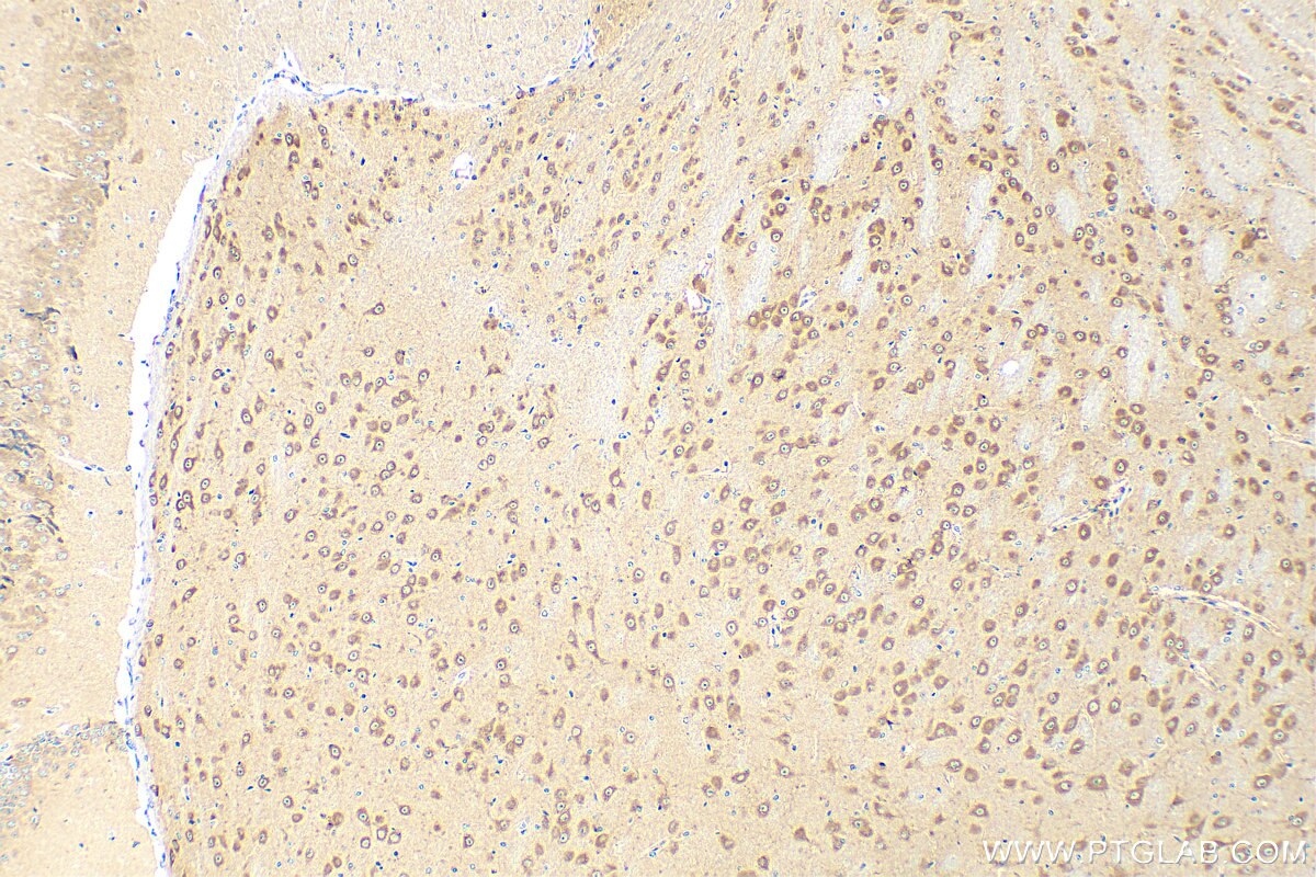 Immunohistochemistry (IHC) staining of mouse brain tissue using CAMK2N1 Polyclonal antibody (25313-1-AP)