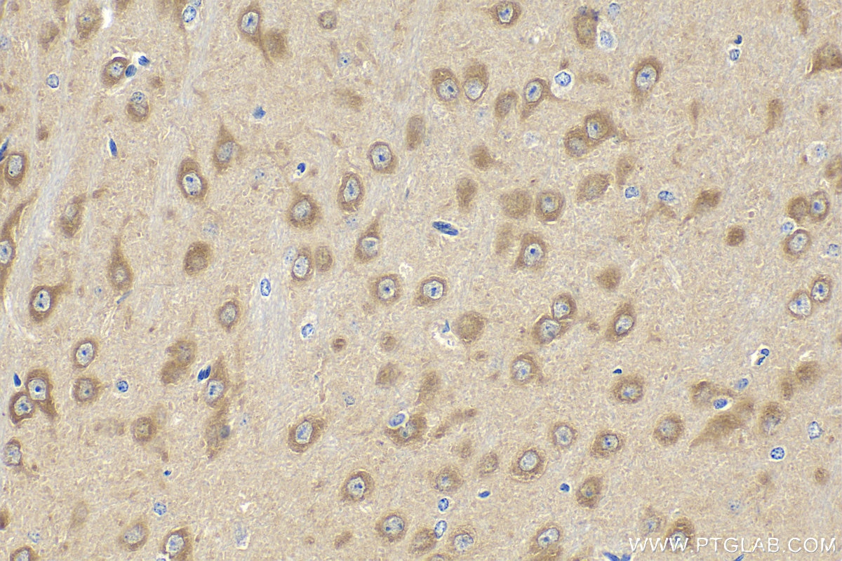 Immunohistochemistry (IHC) staining of mouse brain tissue using CAMK2N1 Polyclonal antibody (25313-1-AP)