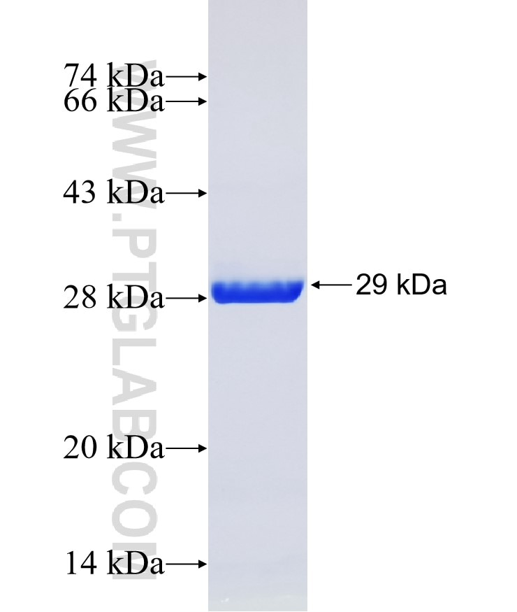 CAMK2N1 fusion protein Ag17950 SDS-PAGE