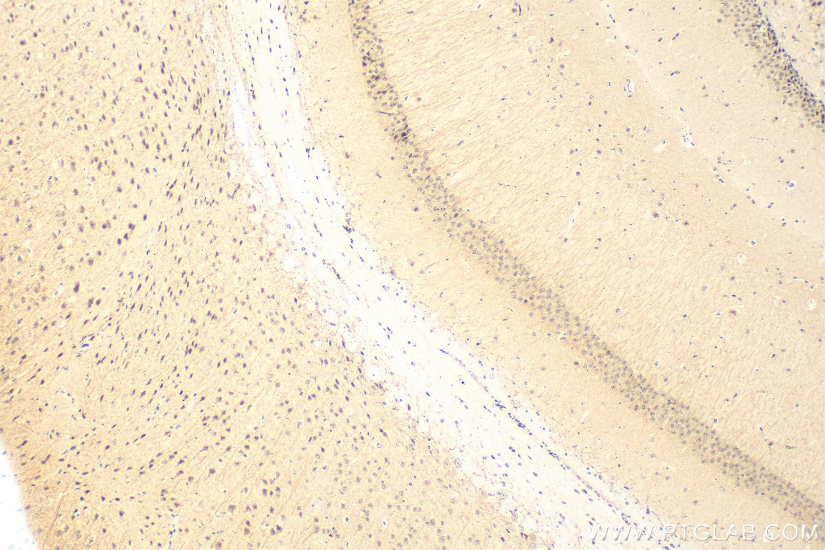 Immunohistochemistry (IHC) staining of mouse brain tissue using CAMK2N2 Polyclonal antibody (28090-1-AP)