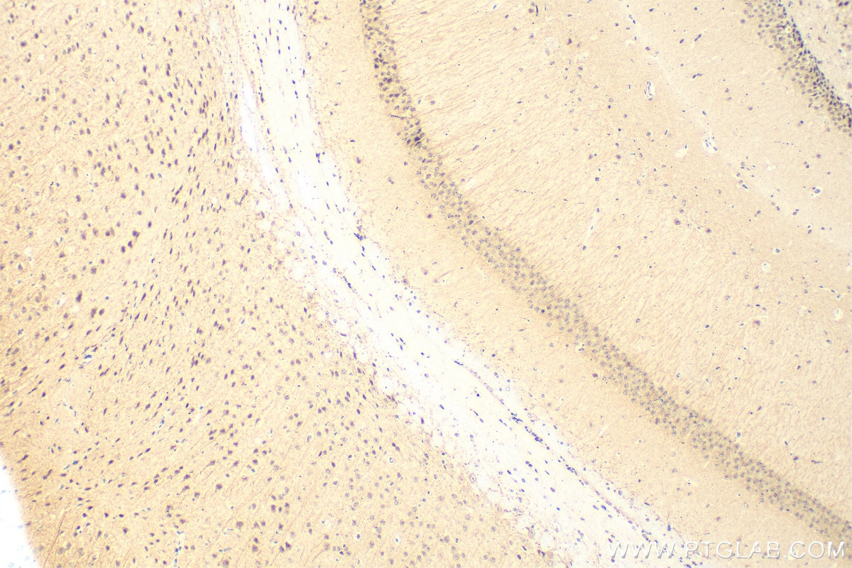 IHC staining of mouse brain using 28090-1-AP