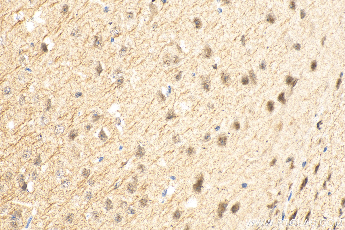 Immunohistochemistry (IHC) staining of mouse brain tissue using CAMK2N2 Polyclonal antibody (28090-1-AP)