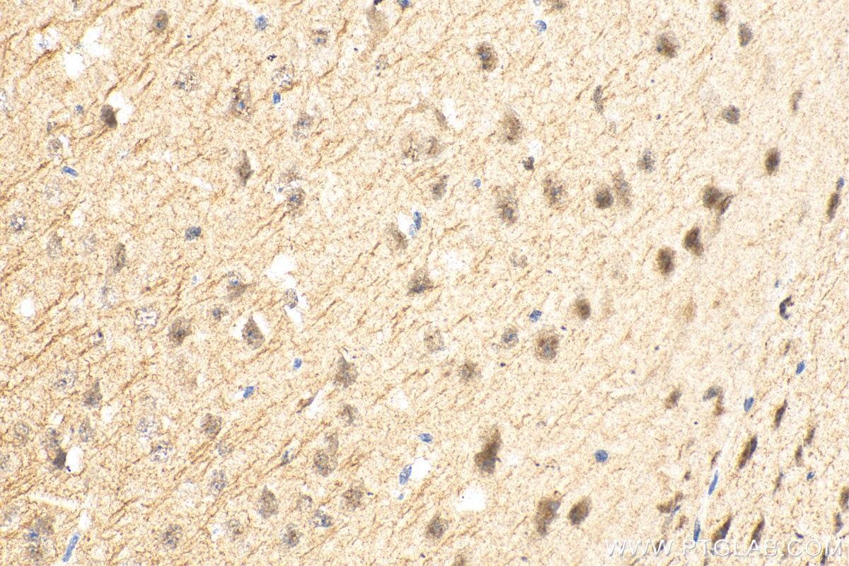 Immunohistochemistry (IHC) staining of mouse brain tissue using CAMK2N2 Polyclonal antibody (28090-1-AP)