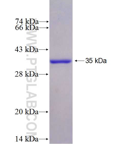 CAMK2N2 fusion protein Ag26872 SDS-PAGE