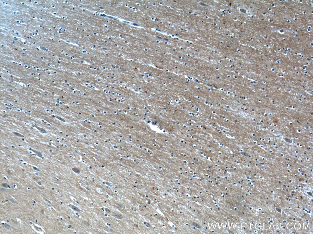 Immunohistochemistry (IHC) staining of human brain tissue using CaMKIV Polyclonal antibody (13263-1-AP)