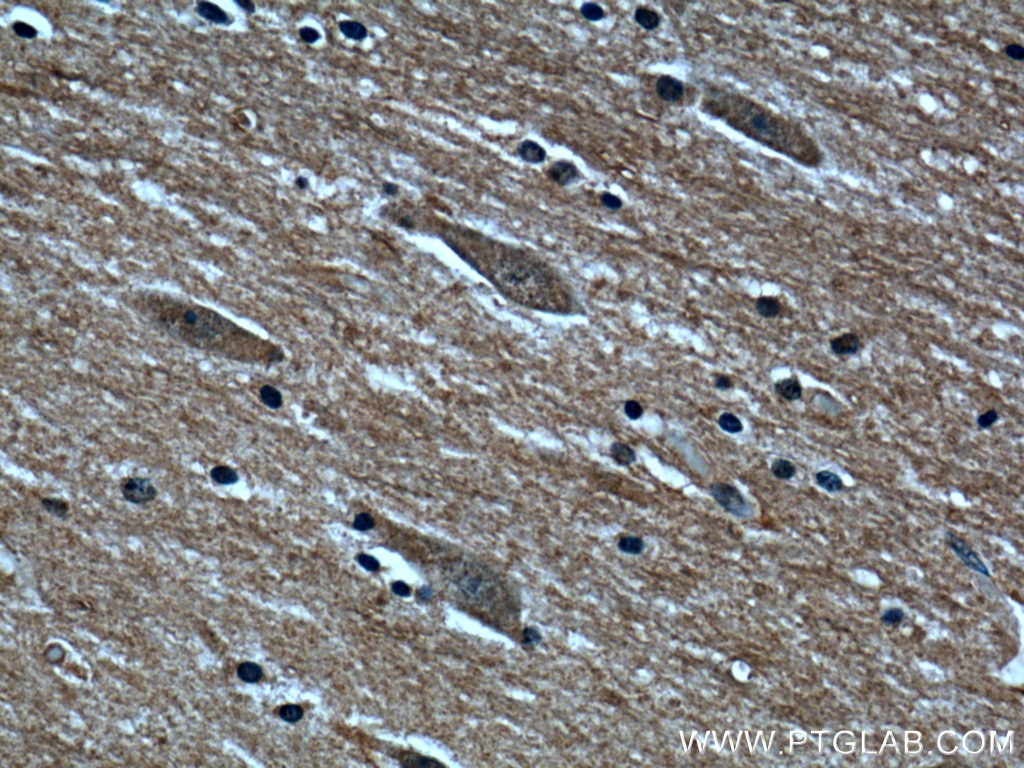 Immunohistochemistry (IHC) staining of human brain tissue using CaMKIV Polyclonal antibody (13263-1-AP)