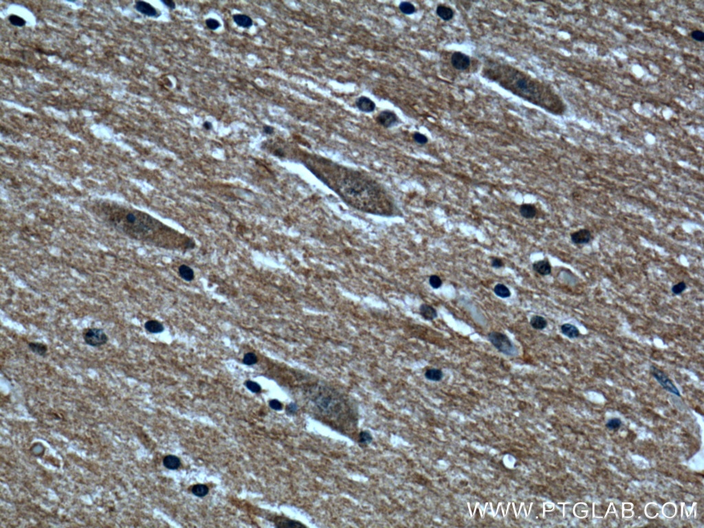 IHC staining of human brain using 13263-1-AP