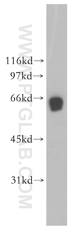 Western Blot (WB) analysis of human cerebellum tissue using CaMKIV Polyclonal antibody (13263-1-AP)