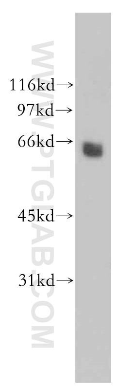 Western Blot (WB) analysis of mouse thymus tissue using CaMKIV Polyclonal antibody (13263-1-AP)