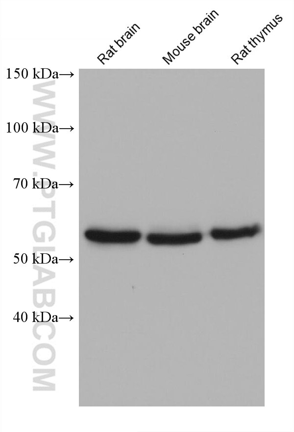 Western Blot (WB) analysis of various lysates using CAMK4 Monoclonal antibody (68452-1-Ig)