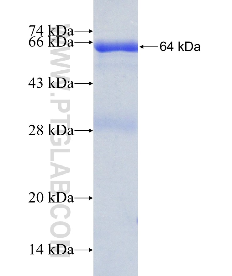 CAMK4 fusion protein Ag3922 SDS-PAGE