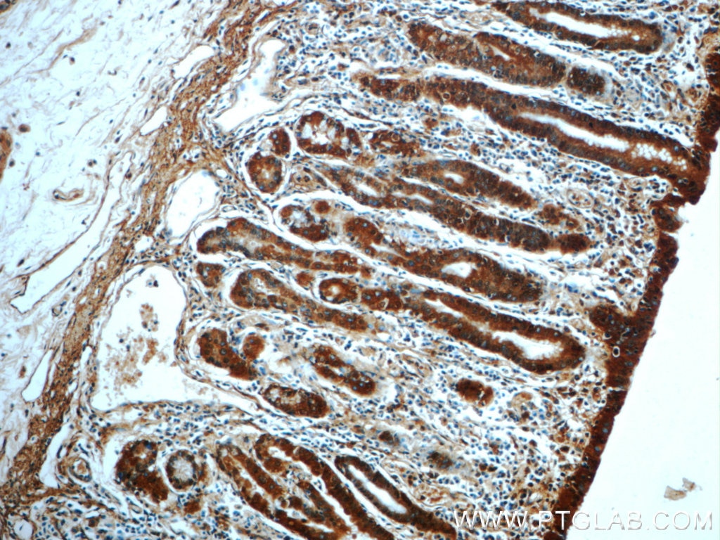 Immunohistochemistry (IHC) staining of human stomach tissue using CAMKK1 Polyclonal antibody (13624-1-AP)