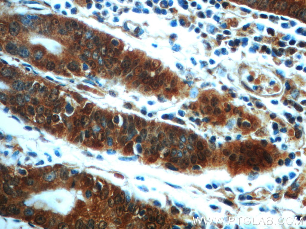 Immunohistochemistry (IHC) staining of human stomach tissue using CAMKK1 Polyclonal antibody (13624-1-AP)