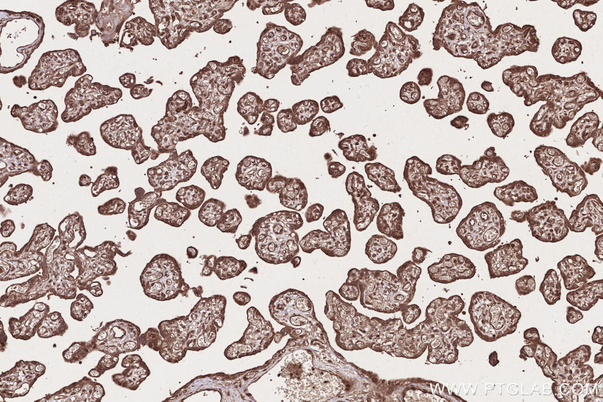 IHC staining of human placenta using 13624-1-AP Immunohistochemistry (IHC) staining of human placenta tissue using CAMKK1 Polyclonal antibody (13624-1-AP)