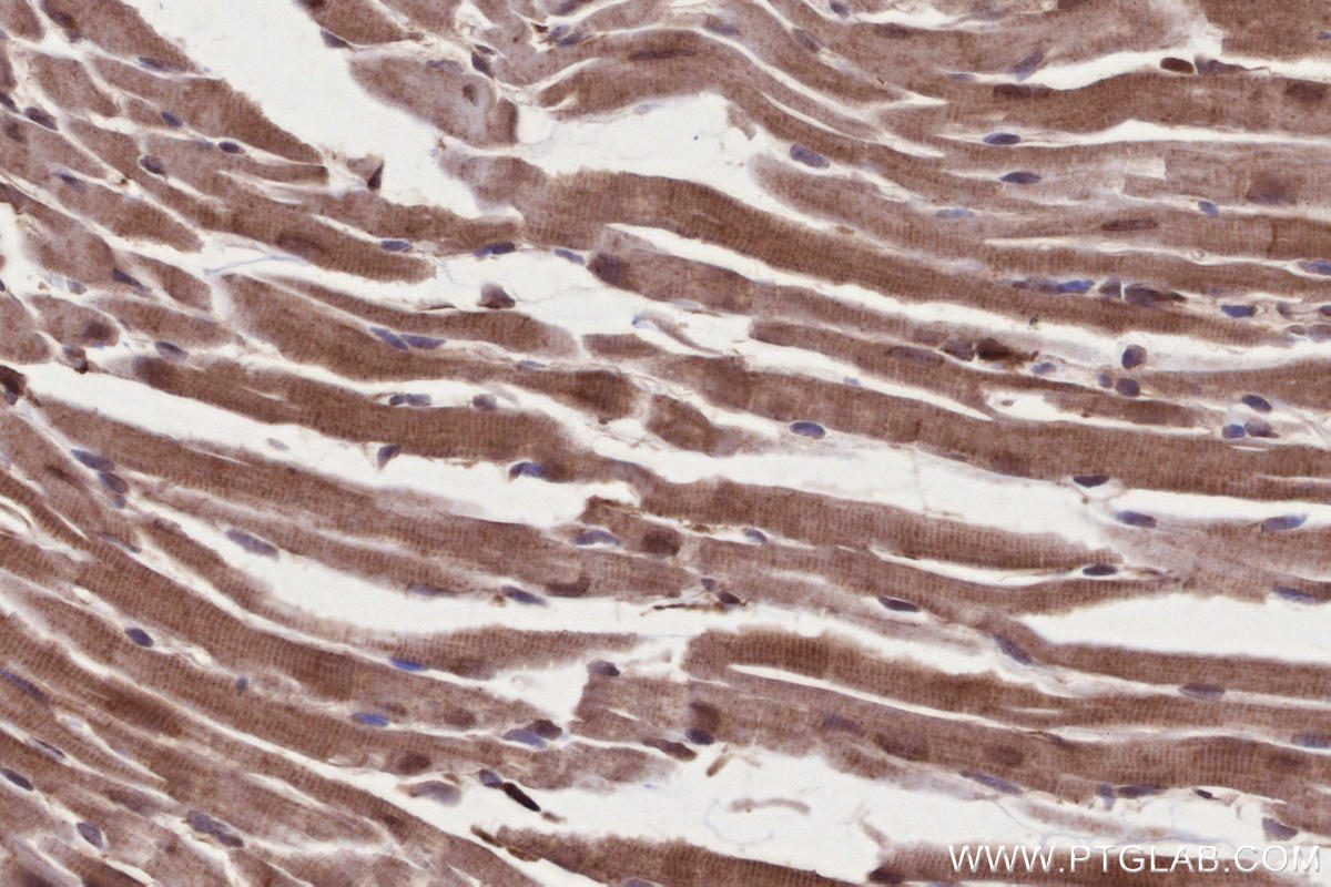 IHC staining of mouse heart using 13624-1-AP Immunohistochemistry (IHC) staining of mouse heart tissue using CAMKK1 Polyclonal antibody (13624-1-AP)