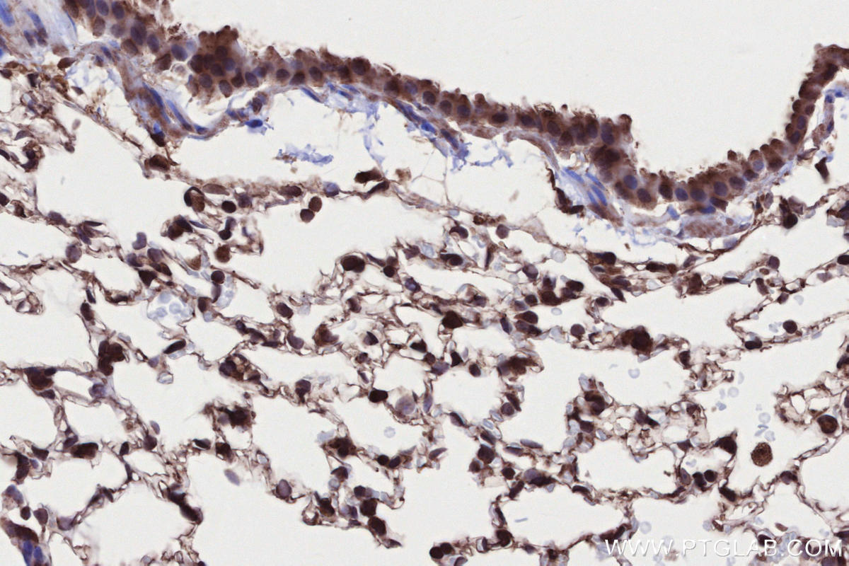 IHC staining of mouse lung using 13624-1-AP Immunohistochemistry (IHC) staining of mouse lung tissue using CAMKK1 Polyclonal antibody (13624-1-AP)