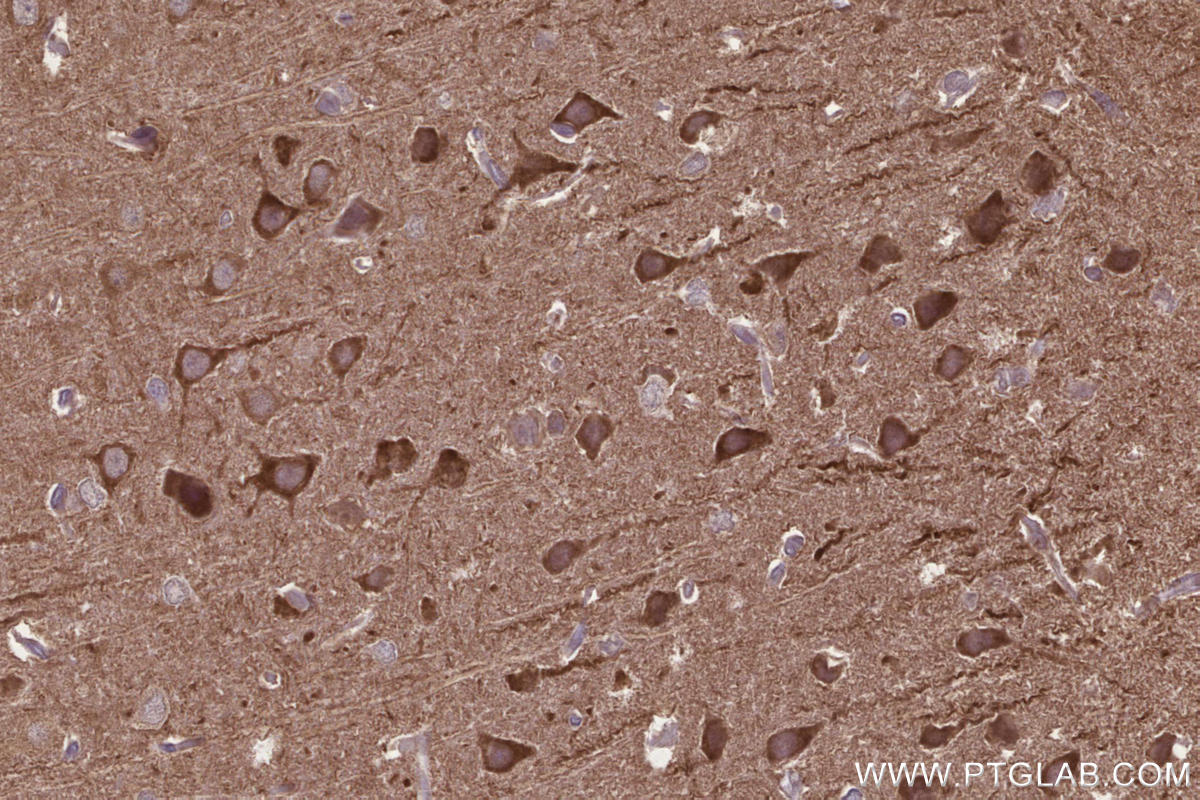 IHC staining of rat brain using 13624-1-AP Immunohistochemistry (IHC) staining of rat brain tissue using CAMKK1 Polyclonal antibody (13624-1-AP)