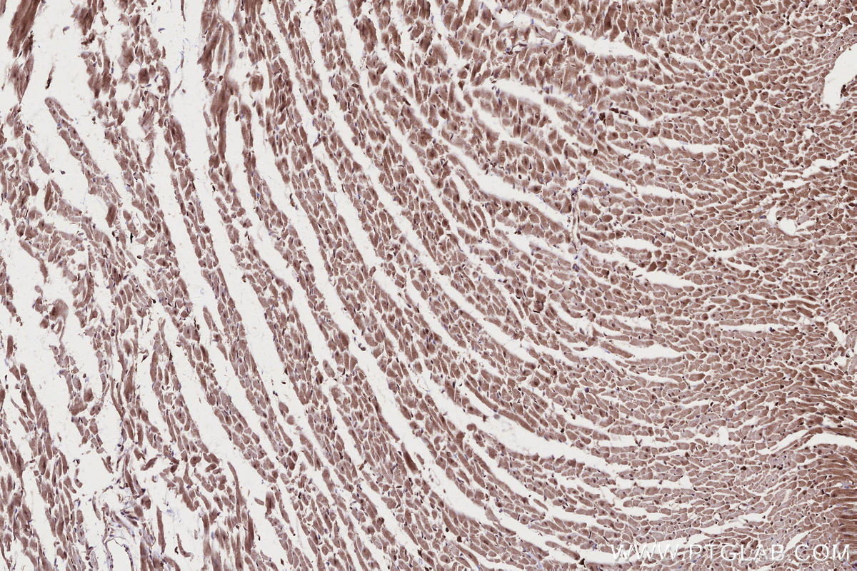 IHC staining of rat heart using 13624-1-AP Immunohistochemistry (IHC) staining of rat heart tissue using CAMKK1 Polyclonal antibody (13624-1-AP)