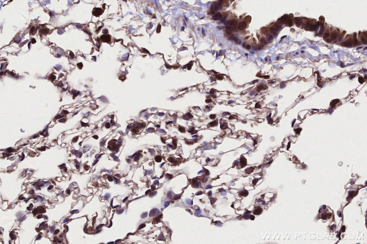 IHC staining of rat lung using 13624-1-AP Immunohistochemistry (IHC) staining of rat lung tissue using CAMKK1 Polyclonal antibody (13624-1-AP)