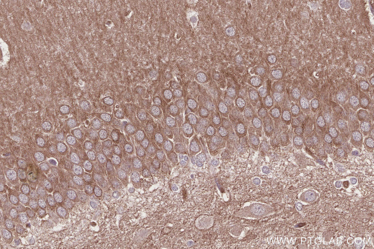 IHC staining of rat brain using 13624-1-AP Immunohistochemistry (IHC) staining of rat brain tissue using CAMKK1 Polyclonal antibody (13624-1-AP)