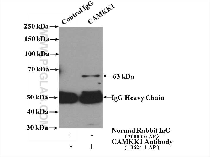 Immunoprecipitation (IP) experiment of Jurkat cells using CAMKK1 Polyclonal antibody (13624-1-AP)