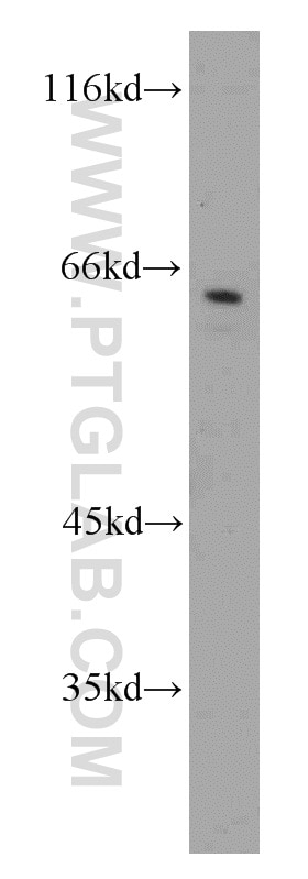 Western Blot (WB) analysis of Jurkat cells using CAMKK1 Polyclonal antibody (13624-1-AP)