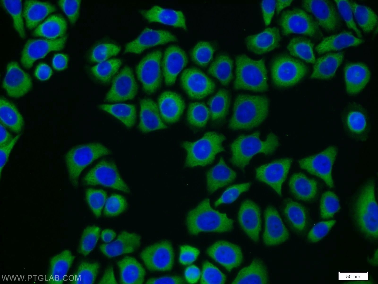 Immunofluorescence (IF) / fluorescent staining of PC-3 cells using CAMKK2 Polyclonal antibody (11549-1-AP)