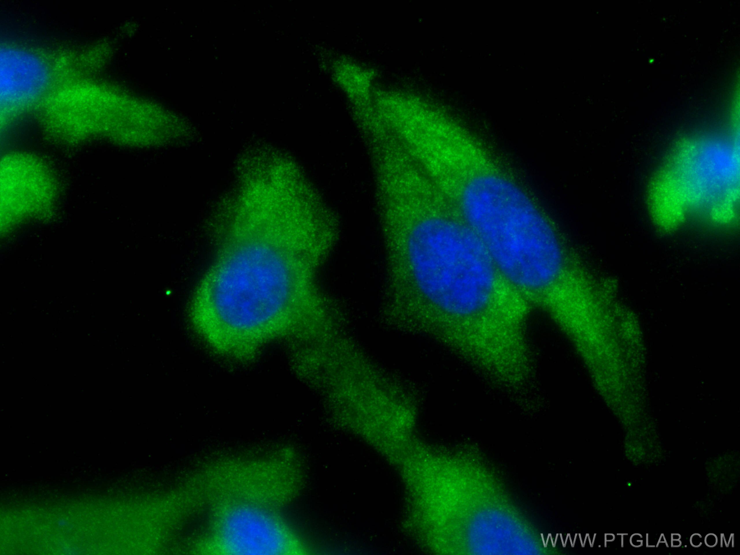 Immunofluorescence (IF) / fluorescent staining of PC-3 cells using CAMKK2 Polyclonal antibody (11549-1-AP)