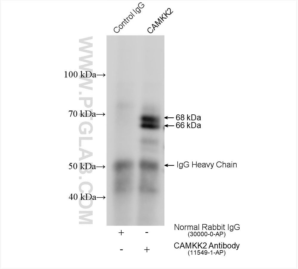 Immunoprecipitation (IP) experiment of PC-3 cells using CAMKK2 Polyclonal antibody (11549-1-AP)