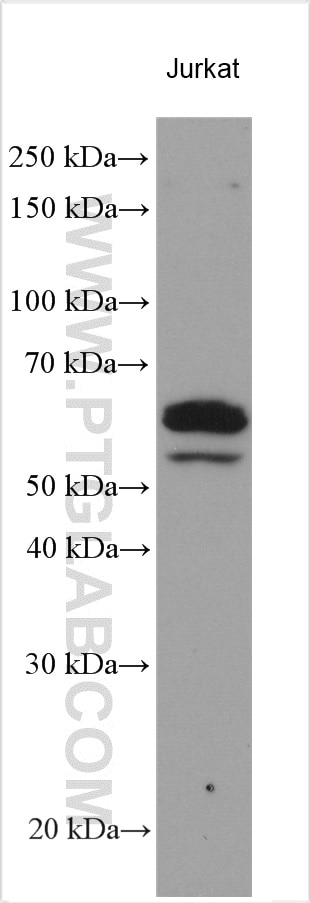 Western Blot (WB) analysis of various lysates using CAMKK2 Polyclonal antibody (11549-1-AP)