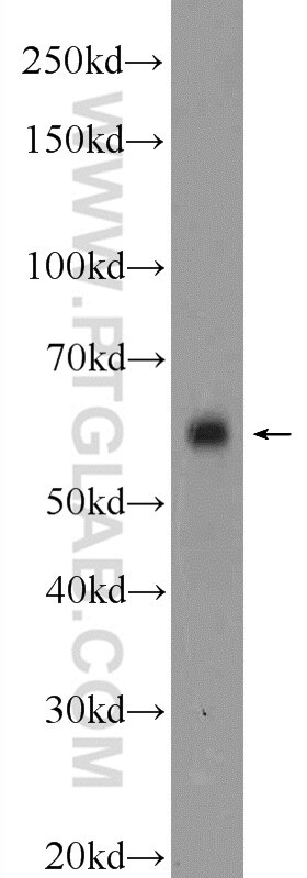 Western Blot (WB) analysis of fetal human brain tissue using CAMKK2 Polyclonal antibody (11549-1-AP)