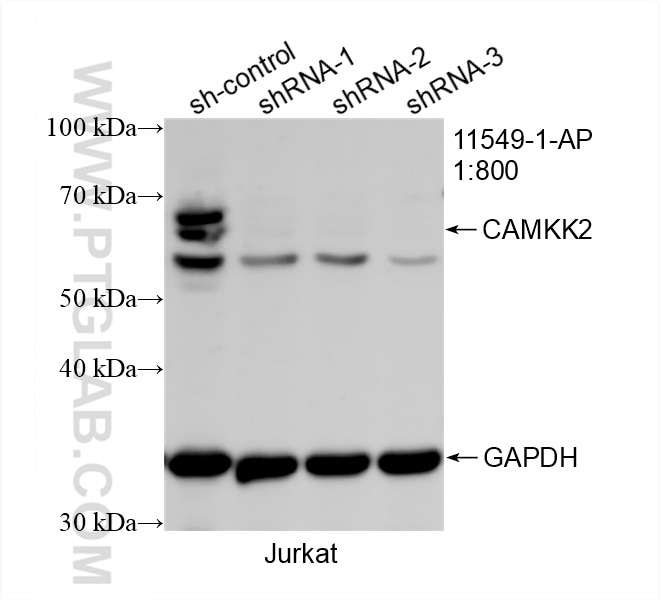 Western Blot (WB) analysis of Jurkat cells using CAMKK2 Polyclonal antibody (11549-1-AP)