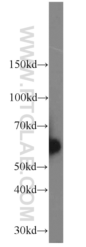 Western Blot (WB) analysis of HeLa cells using CAMKK2 Polyclonal antibody (11549-1-AP)