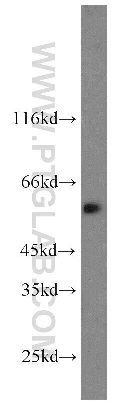 Western Blot (WB) analysis of Jurkat cells using CAMKK2 Polyclonal antibody (11549-1-AP)