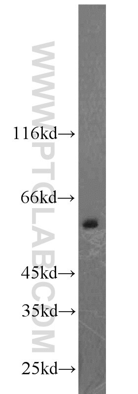 Western Blot (WB) analysis of PC-3 cells using CAMKK2 Polyclonal antibody (11549-1-AP)