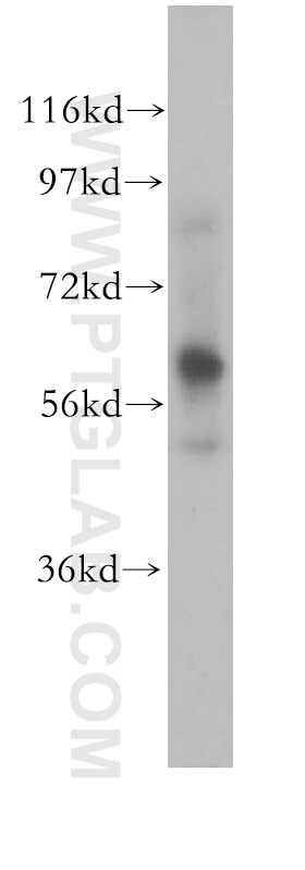 Western Blot (WB) analysis of human heart tissue using CAMKK2 Polyclonal antibody (11549-1-AP)