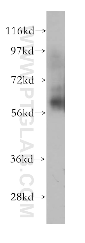 Western Blot (WB) analysis of human brain tissue using CAMKK2 Polyclonal antibody (11549-1-AP)