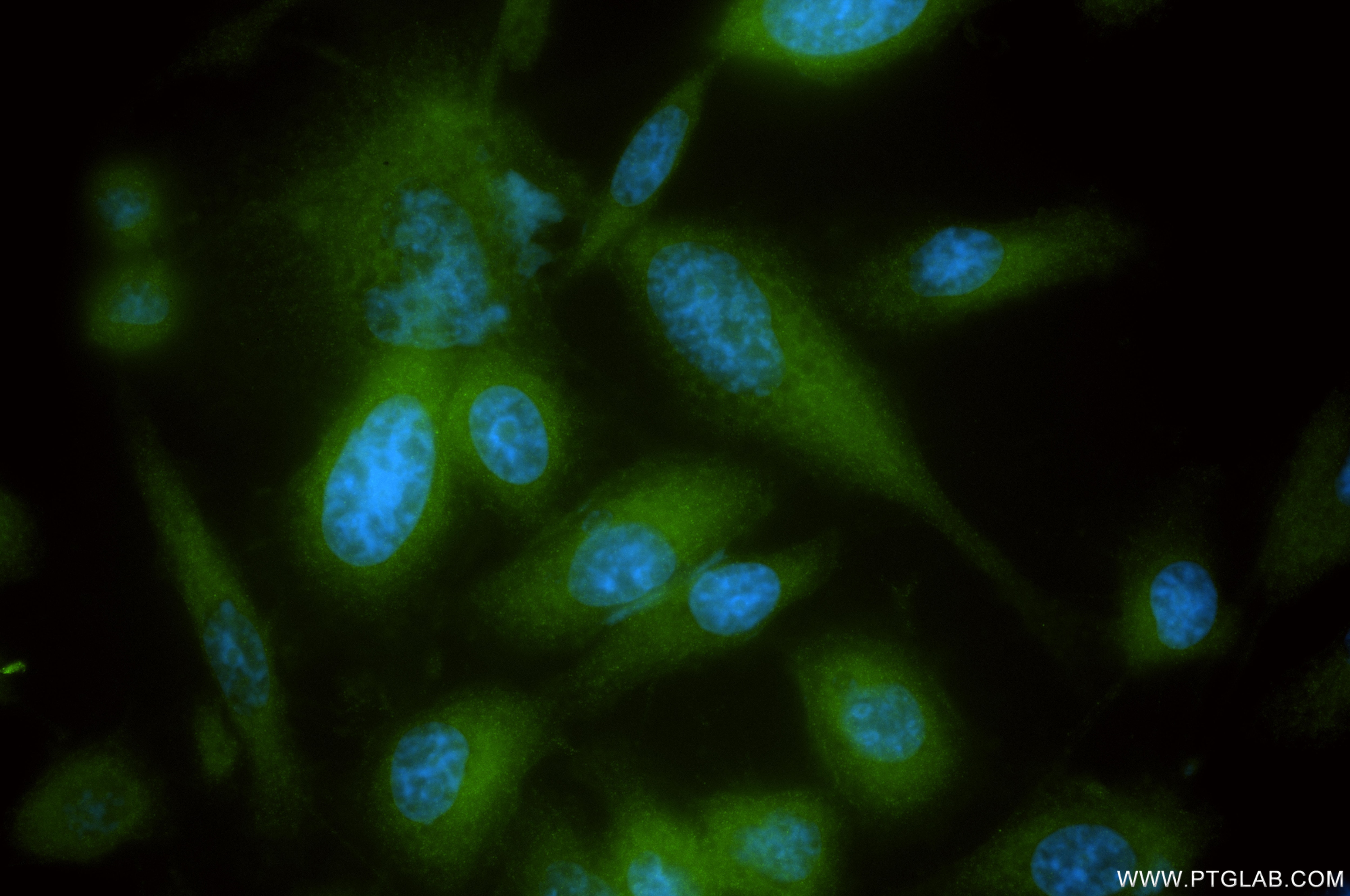 Immunofluorescence (IF) / fluorescent staining of PC-3 cells using CAMKK2 Recombinant antibody (82720-14-RR)
