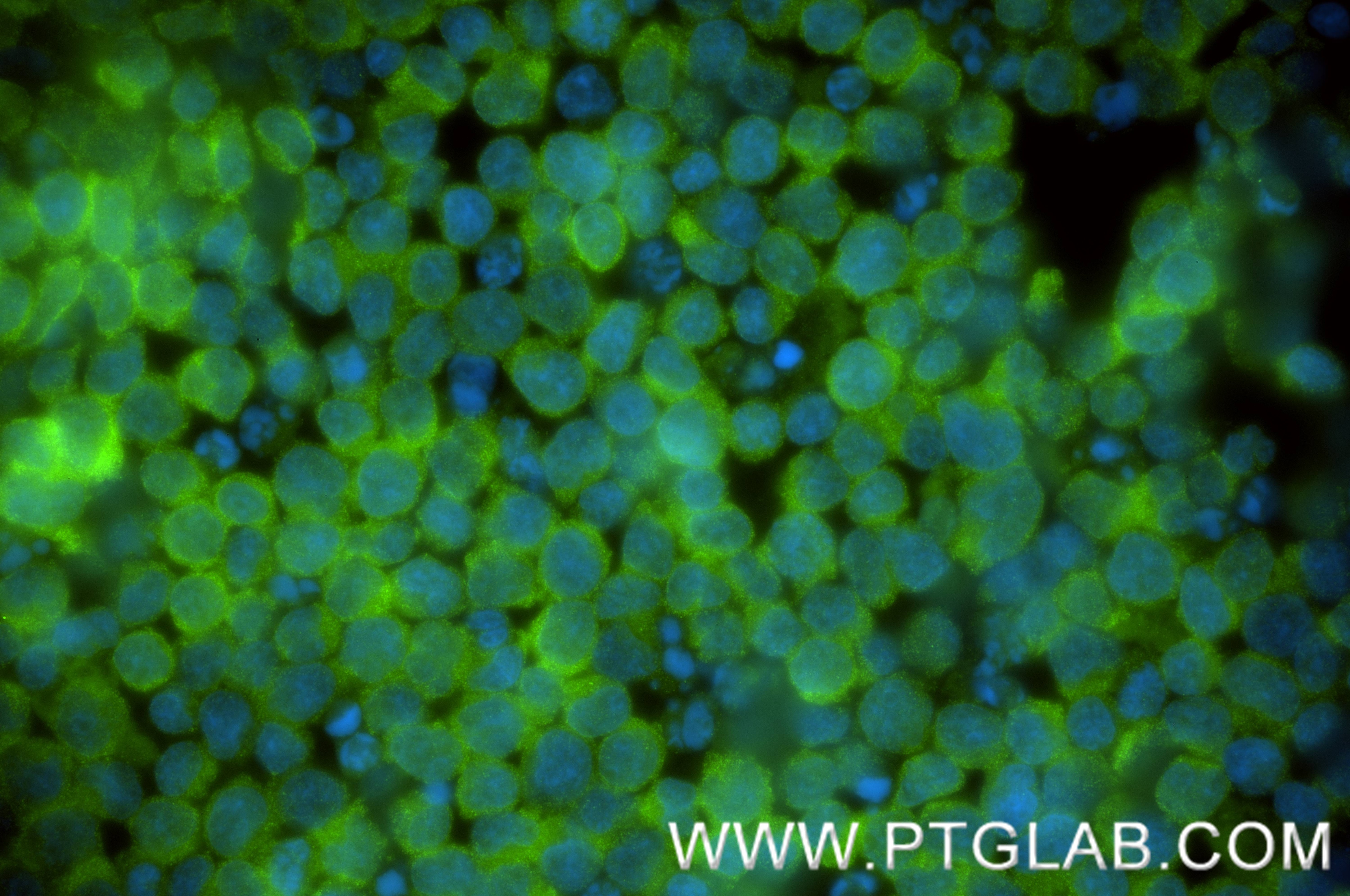 Immunofluorescence (IF) / fluorescent staining of Jurkat cells using CAMKK2 Recombinant monoclonal antibody (82720-14-RR)
