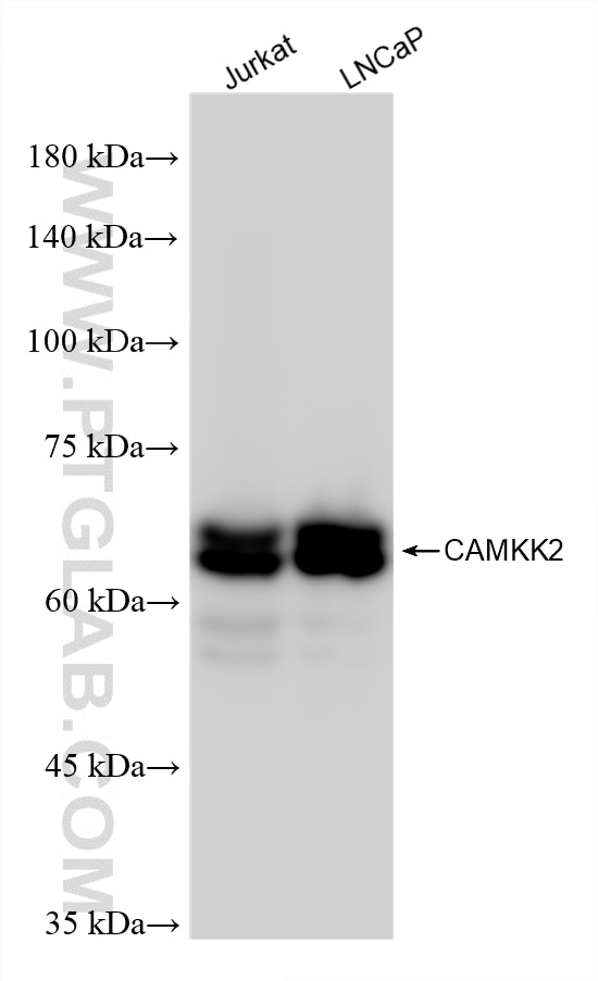 Western Blot (WB) analysis of various lysates using CAMKK2 Recombinant antibody (82720-14-RR)