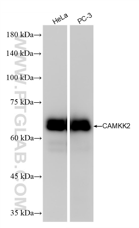 Western Blot (WB) analysis of various lysates using CAMKK2 Recombinant antibody (82720-14-RR)