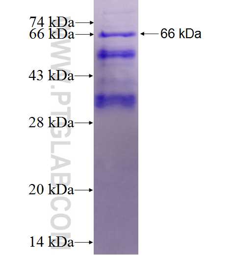 CAMKK2 fusion protein Ag2093 SDS-PAGE