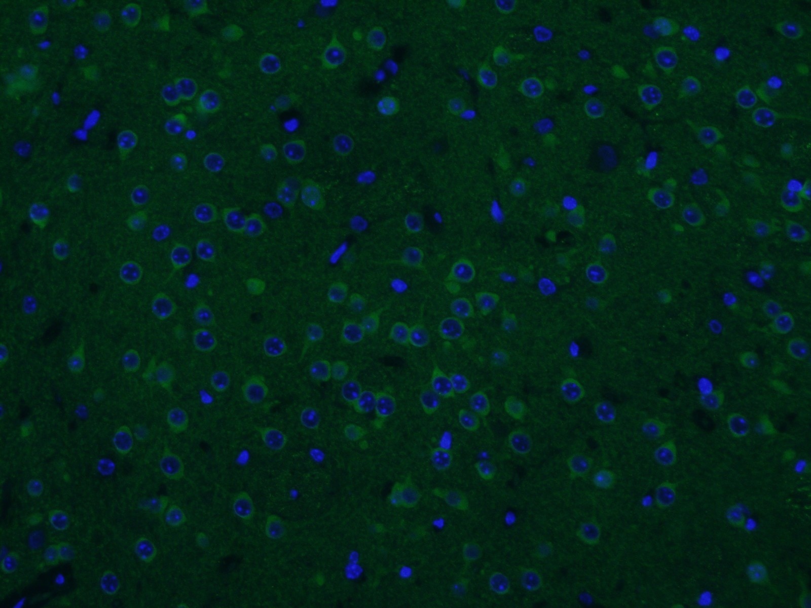 Immunofluorescence (IF) / fluorescent staining of mouse brain tissue using CAMKV Polyclonal antibody (14788-1-AP)