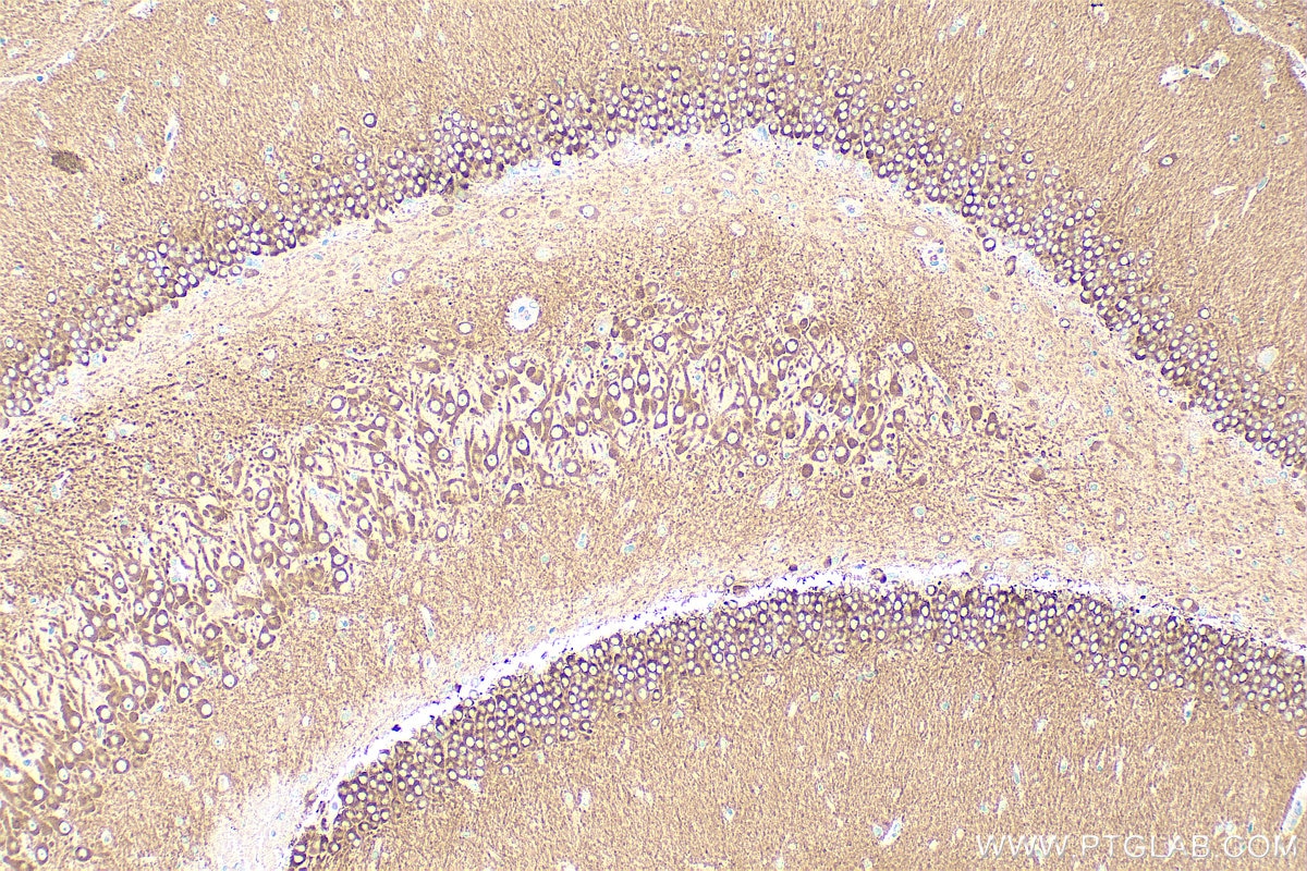 Immunohistochemistry (IHC) staining of rat brain tissue using CAMKV Polyclonal antibody (14788-1-AP)