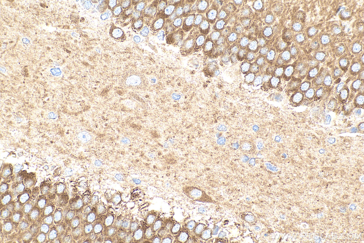 Immunohistochemistry (IHC) staining of rat brain tissue using CAMKV Polyclonal antibody (14788-1-AP)