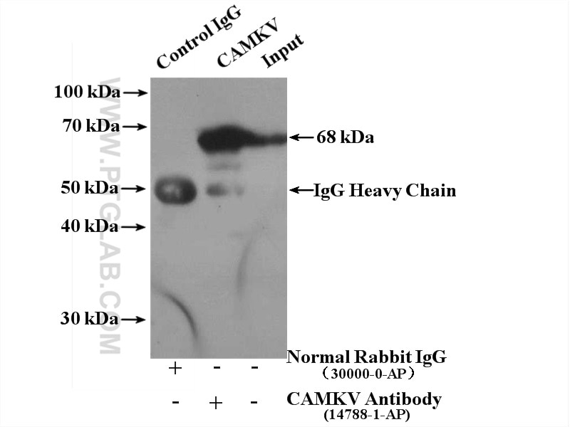 Immunoprecipitation (IP) experiment of mouse brain tissue using CAMKV Polyclonal antibody (14788-1-AP)