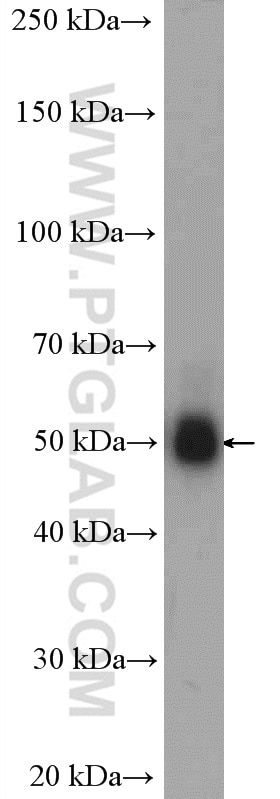 WB analysis of PC-3 using 14788-1-AP