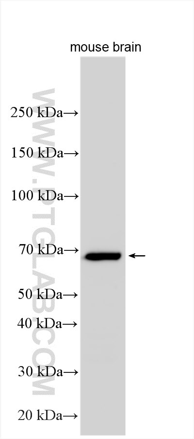 WB analysis using 14788-1-AP Western Blot (WB) analysis of various lysates using CAMKV Polyclonal antibody (14788-1-AP)